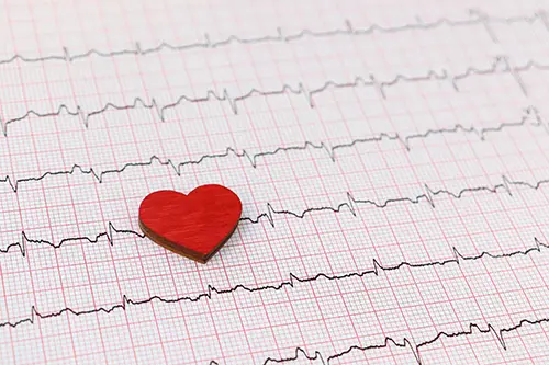 Elettrocardiogramma presso Farmacia Vescovana Elettrocardiogramma presso Farmacia Vescovana