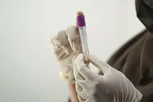 Screening Sangue Occulto presso Farmacia Vescovana Screening Sangue Occulto presso Farmacia Vescovana